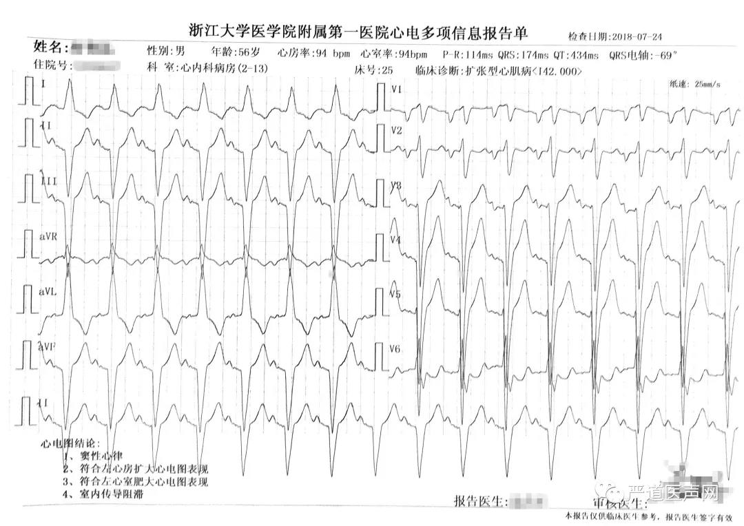 左右室壁运动弥漫性减低,下腔静脉扩张,二,三尖瓣中度反流,肺动脉高压