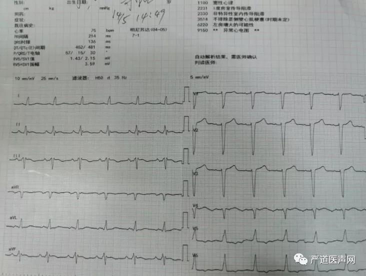 患者术后十二导联心电图