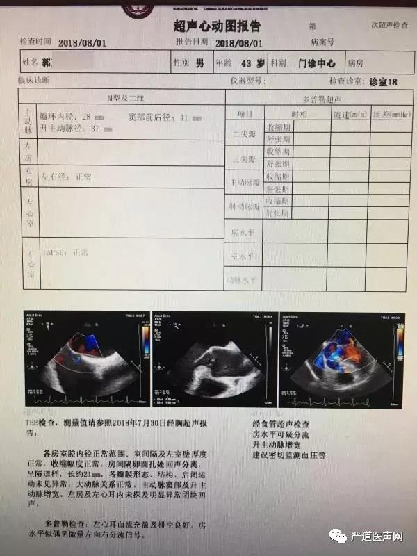 3例患者超声心动图潘湘斌团队诊疗范围:1,成人瓣膜病:"不开刀修复瓣膜