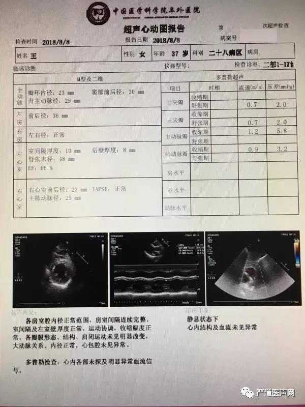 3例患者超声心动图潘湘斌团队诊疗范围:1,成人瓣膜病:"不开刀修复瓣膜