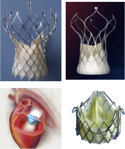 不开胸心脏跳动下微创介入心脏瓣膜手术研讨会在北京安贞医院胜利举行