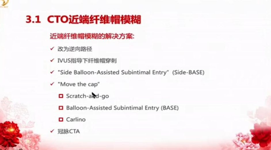 1 cto近端纤维帽模糊纤维帽模糊03external cap crush技术要领:第一步